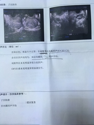 内膜回声欠均匀影响怀孕吗