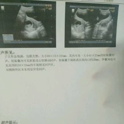 怀孕10周图片