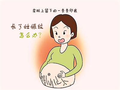 坐月子期间会怀孕吗