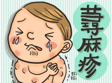 宝宝麻疹的症状和治疗