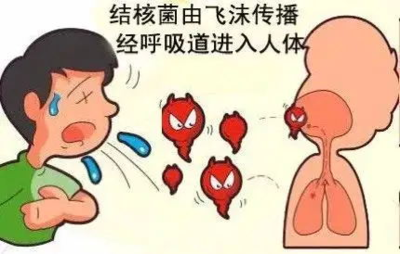 咳嗽有血丝