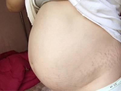 1岁宝宝肚子大正常吗