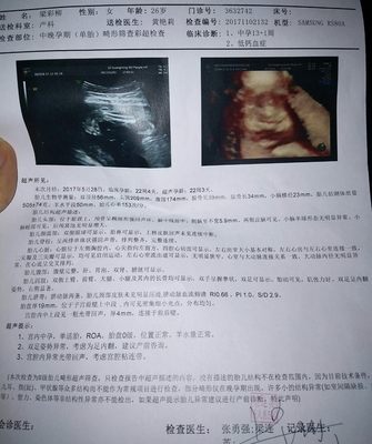 胎儿22周图片