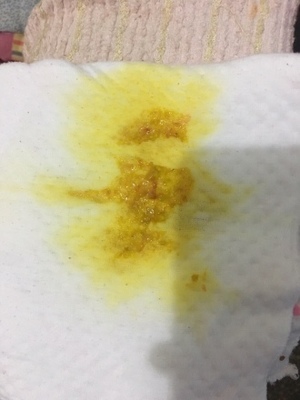 宝宝一天半没有大便了
