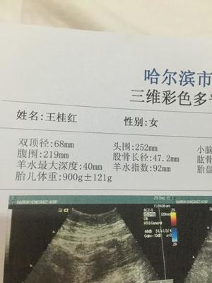 8个月头围