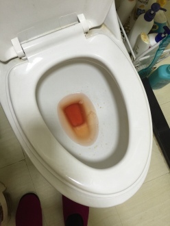 小便出血是怎么回事男