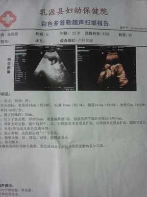 怀孕胎盘低置怎么办