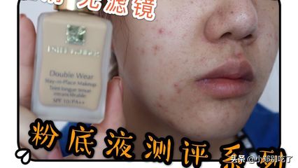 痘痘肌用后的哪个系列