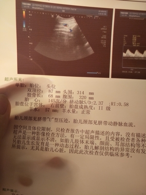 怀孕36周孩子一般几斤