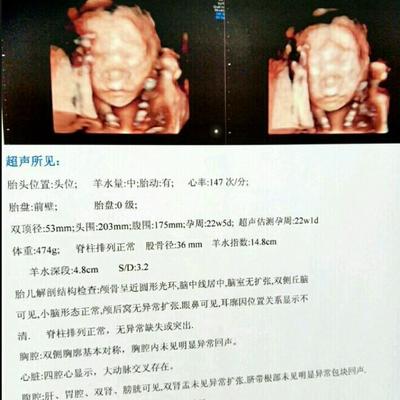 胎儿22周图片