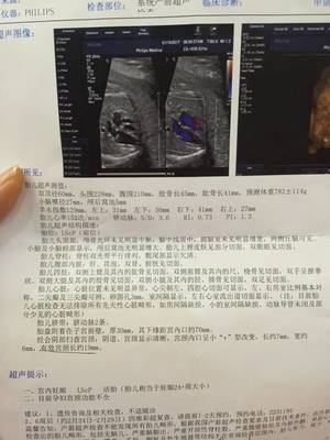 怀孕6个月做什么检查