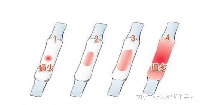 月经量30毫升大概是多少毫升