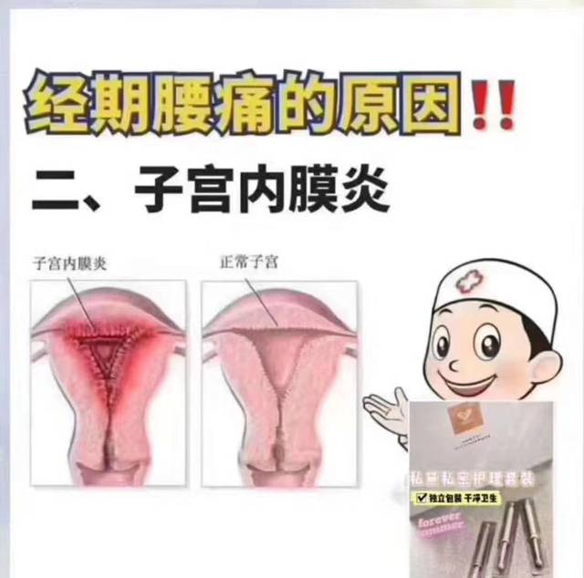经血呈褐色是怎么回事