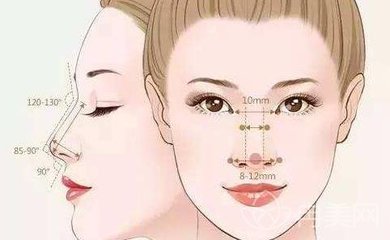 玻尿酸和假体隆鼻
