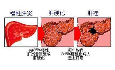 肝炎怎么治疗最好的方法