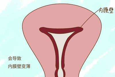人流后怀孕容易流产吗