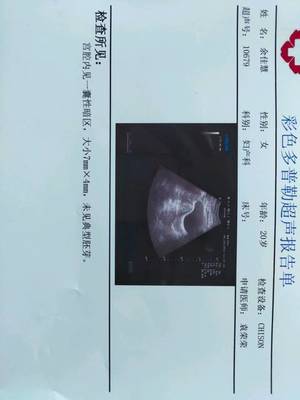 怀孕40天小孩有多大