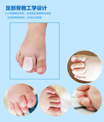宝宝脚趾内扣图片
