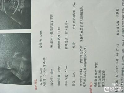胎儿绕颈三周