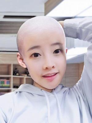 梦见自己变成秃头