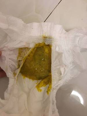 宝宝拉绿便怎么办