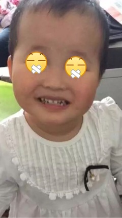 三岁宝宝补牙受罪不