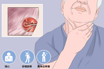 食道疼是怎么回事