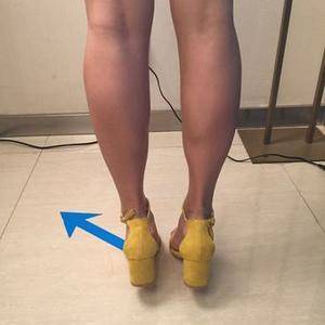 瘦腿哪里整容