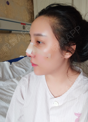 做了假体长痘痘
