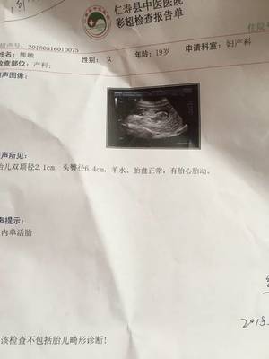 3个月的胎儿有多大