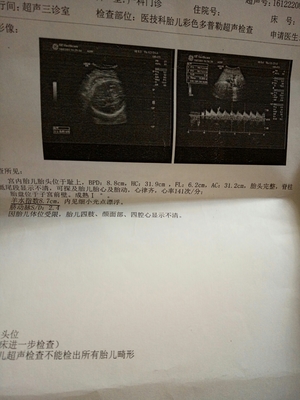 胎儿多少斤正常