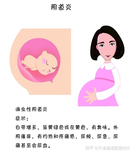 霉菌会影响胎儿吗