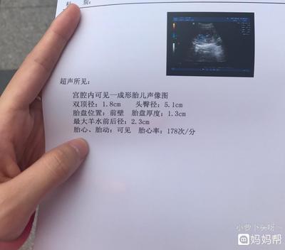 胎儿心跳太快怎么回事