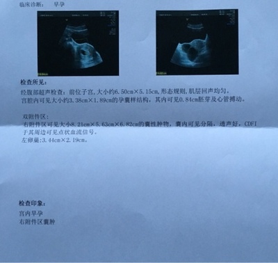 怀孕期间白带多