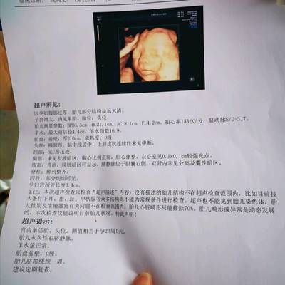怀孕四个月胎动不明显正常吗