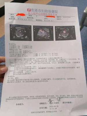 胎儿心脏彩超检查什么内容