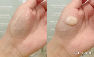 痘痘肌用哪种水乳比较好