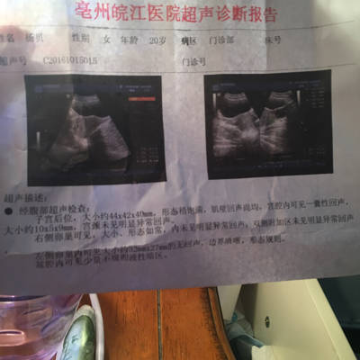 怀孕40天能看出男女吗
