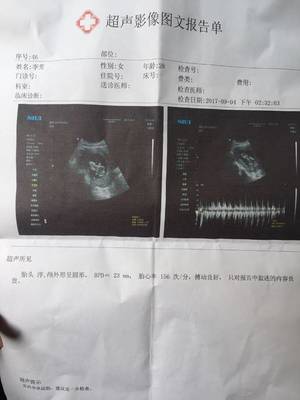 怀孕14周宝宝有多大