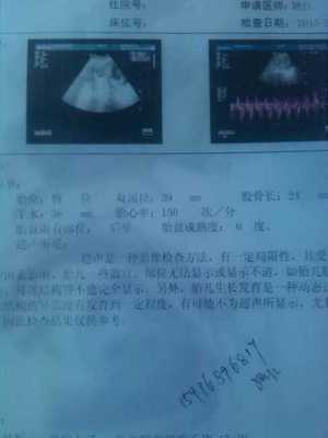 怀孕四个月怎么看男女