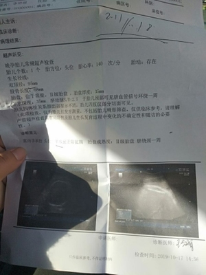 怀孕36周是多少个月