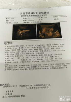 孕妇32周做什么检查