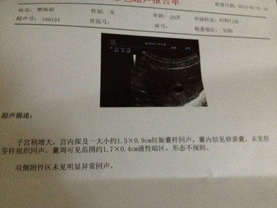 怎么看怀孕没