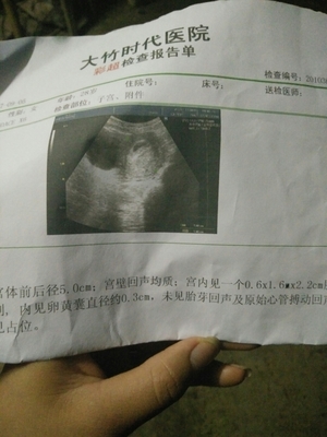 怀孕40天孩子多大