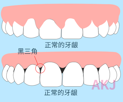 怎么治牙齿会松动