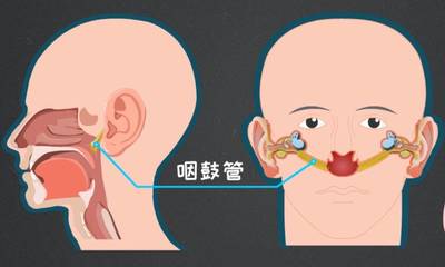 咽鼓管堵塞怎么治疗