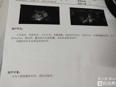 怀孕七周可以做人流吗