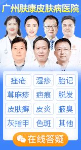 廣州哪裡看痘痘