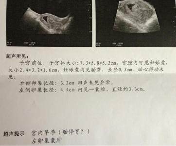 二个月胎儿有多大