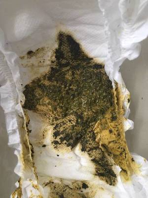 宝宝粑粑里有黑色颗粒